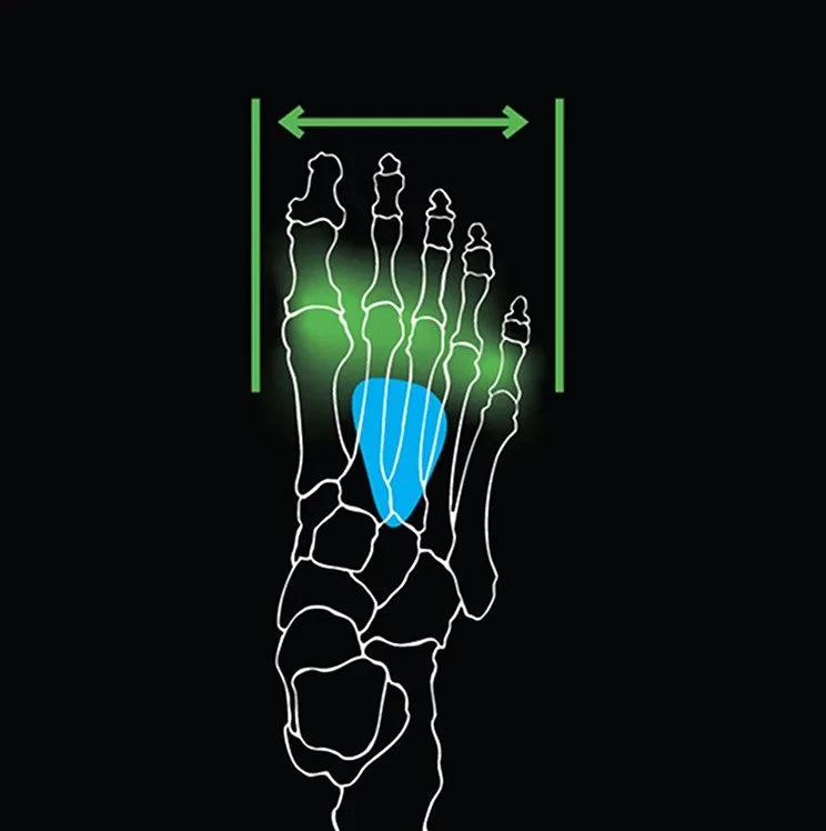 Metatarsal Button